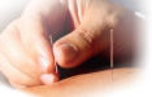 tratamiento acupuntura ovario poliquistico tratamiento acupuntura ovario poliquistico