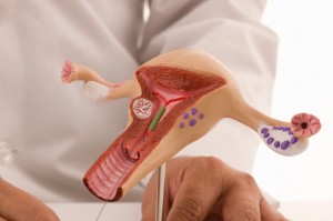 Endometriosis Endometriosis